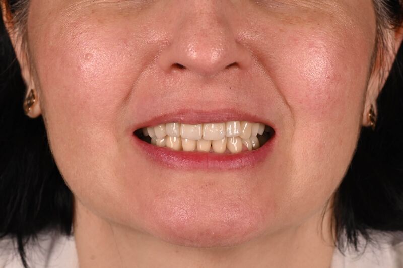 berghian anca - dupa